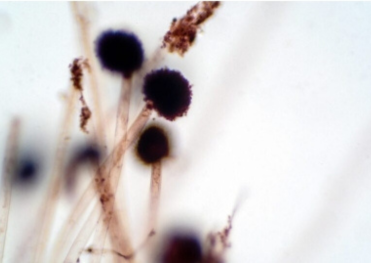 「麹菌の顕微鏡写真｜味噌や醤油の発酵を支える微生物の構造と働きを示す科学的イメージ」