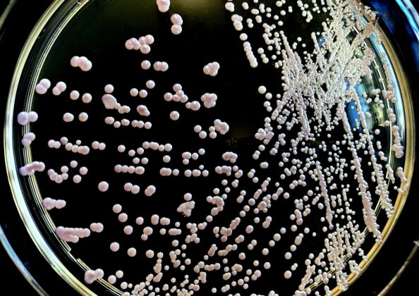 「発酵に関与する酵母菌の培養画像｜微生物の働きと食品発酵の科学的メカニズムを示す実験例」