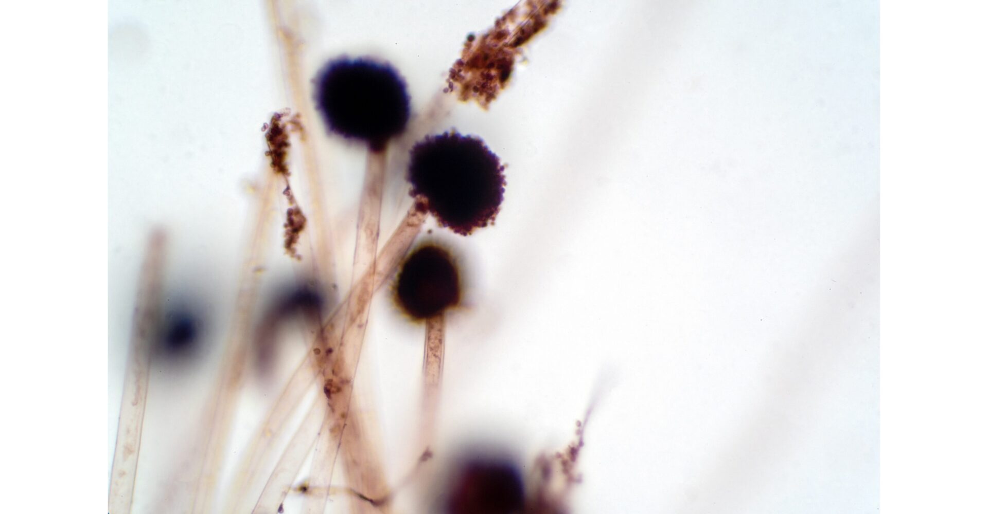 「顕微鏡で捉えた麹菌の胞子と菌糸。発酵食品の製造に欠かせない微生物で、味噌や醤油、清酒などの風味を生み出す源。」